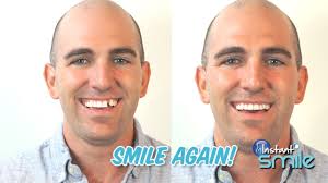 Tooth Repair Instant Smile Temporary Tooth Replacement Kit