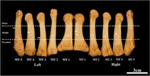 Image result for Metatarsal