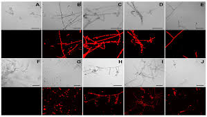 Fonsecaea pedrosoi (brumpt) negroni, rev. Jof Free Full Text Agrobacterium Tumefaciens Mediated Transformation Of Fonsecaea Monophora And Fonsecaea Erecta For Host Environment Interaction Studies Html