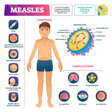 Image result for measles