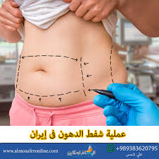 تكلفة شفط الدهون في إيران شركة المسافر أونلاين السياحة العلاج التجارة