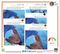 تشخيص مرضى الارتجاع يحدث عادة عند وجود الأعراض النمطية.19 من الممكن ان يحدث الارتجاع المريئي بدون الأعراض والتشخيص بحاجة إلى وجود الأعراض أو المضاعفات وارتداد محتوى المعدة. Facebook