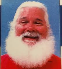 Why is my beard white