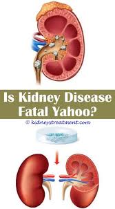 Kidney Stones Look Like Kidney Disease Awareness Polycystic Kidney Disease Kidney Disease