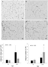 We did not find results for: Maternal Consumption Of Fish Oil Programs Reduced Adiposity In Broiler Chicks Scientific Reports