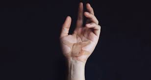 Point de suture (english translation). J Ai Des Points De Sutures Comment Surveiller Ma Plaie