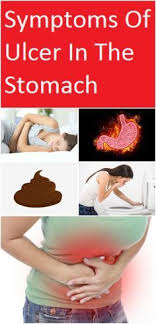 Symptoms Of Ulcer In The Stomach Scheduled Via Http Www Tailwindapp Com Utm Source Pinterest Utm Medium Twpin Ulcer Symptoms Stomach Ulcers Symptoms Ulcers