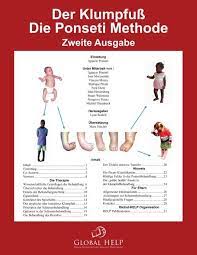 Translate clubfoot in german online and download now our free translator to use any time at no charge. Clubfoot Ponseti Management 2nd Edition German Global Help