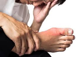 Untuk anda (pesakit kencing manis) yang sedang melarat & memerlukan. Hati Hati Ini Gejala Awal Masalah Kaki Diabetes Okezone Lifestyle