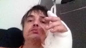 The libertines frontman was arrested twice over the weekend for attempting to buy drugs and for his involvement in a drunken brawl. Singer Pete Doherty Thanks Nhs After Piercing Hand On Hedgehog Ents Arts News Sky News