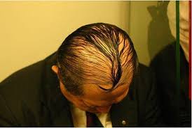Hairstyles To Hide Baldness Comb Over Bad Haircut Wacky Hair