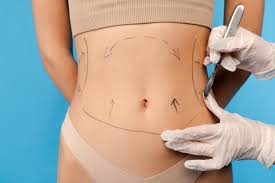 VASER Lipo Cost Breakdown: What You're Really Paying For | Edward Lee, MD I  Nuveau Plastic Surgery + Medical Aesthetics