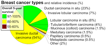 Invasive Carcinoma Of No Special Type Wikipedia