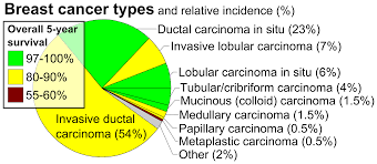 invasive carcinoma of no special type wikipedia