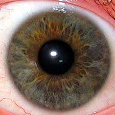 Iridology Wikidoc