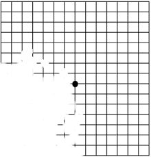 Jejunes Place Amsler Grids