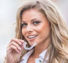 Invisalign Full VS Lite?