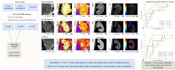 Tradeshowguy monday morning coffee, august 3, 2020: Jcm Free Full Text Multiparametric Assessment Of Changes In Renal Tissue After Kidney Transplantation With Quantitative Mr Relaxometry And Diffusion Tensor Imaging At 3 T Html