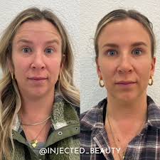 Audrey Crews, APRN, FNP-C