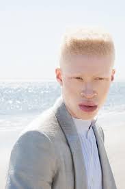 Shaun Ross, the first Afro-American Male Model born with Albinism |