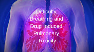 Image result for Pulmonary Intoxicant
