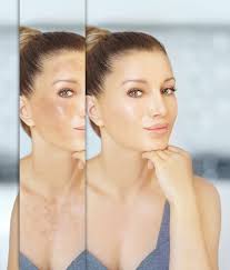 How to prep your skin for your BIG Day