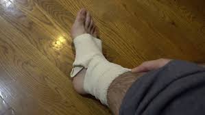 Apr 07, 2019 · begin wrapping the bandage around the ball of your foot. Injured Foot And Bandage Stock Footage Video 100 Royalty Free 21649588 Shutterstock