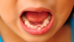 7 Great Ways To Pull A Loose Tooth Loose Tooth Loose Teeth Kids Loose Tooth Removal