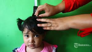 Pravelensi balita stunting di indonesia adalah yang tertinggi dibandingkan myanmar (35%), vietnam (23%), malaysia (17%), thailand (16%) dan singapura (4%) dikutip dari (unsd, 2014). Peran Pos Yandu Menurunkan Stunting Di Masa Pandemi Covid 19 Tribunnews Com Mobile