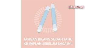 Kb Implan Proses Pemasangan Efek Samping Kelemahan Dan Kelebihannya Berbagi Cerita Opini Edukasi Dan Hiburan Cerita Jenis