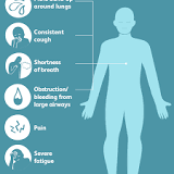 Image result for how long can you live with fluid on lungs from cancer without treatment?