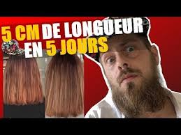Comment faire pousser ses cheveux plus vite ? Pousse Des Cheveux 5 Cm Grace A Une Gelule Youtube