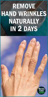 How To Remove Wrinkles From Hands Naturally In 2 Days Skin Care Wrinkles Home Remedies For Wrinkles Wrinkle Remover