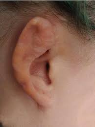 Get the best deals on elf ears. Woman Left With Mutilated Ears After Surgery To Make Her Look Like A Pixie Daily Mail Online