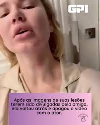 🚨Essa semana veio à tona, uma grave acusação contra o ator Dado Dolabella,  feita pela influenciadora Rafaela Clemente, envolvendo agressões à modelo  Marcela Tomaszewski. , O caso reforça a importância ...