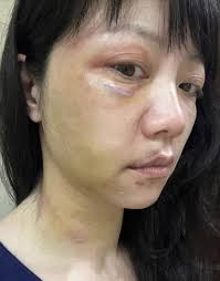 高嘉瑜放弃上诉！ 林秉枢秋节后入狱14天了事｜壹苹新闻网