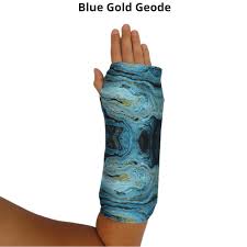 Image result for Short Arm Cast
