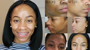 Make a thick paste from the turmeric powder and include the cucumber juice or turmeric lighten skin before and after. The Best 15 Pigmentation Dark Spots Before And After Herbalife Skin Care Products