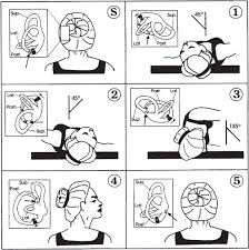 So it is really all about how you maneuver the head. 3 6 Vertigo Ento Key