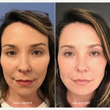 Renew Aesthetic Clinic