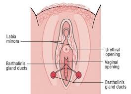 Image result for Bartholin's gland abscess