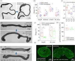 You can highlight the roles that interact with the system and the functionality provided by the system without going deep into inner workings of the system. Smooth Muscle Contractility Causes The Gut To Grow Anisotropically Journal Of The Royal Society Interface