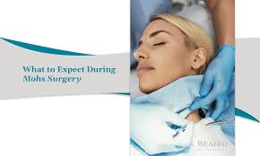 What to Expect During Mohs Surgery