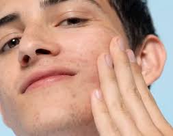 Bí quyết chăm sóc làn da khô cho bố và con trai