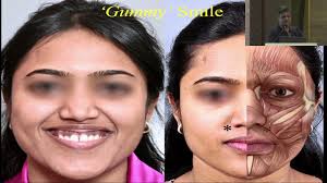 AIOC 2023 GP57 topic Dr Milind Naik Periocular Aesthetic Surgery