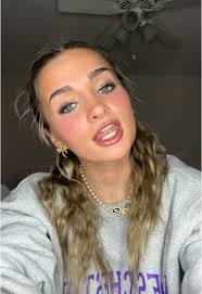 Allyson Goldberg's Instagram, Twitter & Facebook