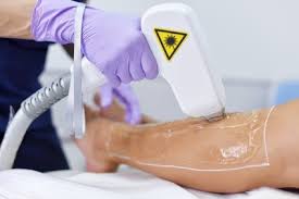 If you are a teenager and want to get it done, you can consult your parents and elders and then look for a certified and professional clinic to get the best service. How To Treat Laser Hair Removal Burns Accident Claims Advice