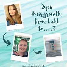 Rinse the blade after every stroke to get rid of excess shaving cream and hair. Hair Growth After A Head Shave 2yrs Of Growth From A Grade 1 To Hannah Spannah