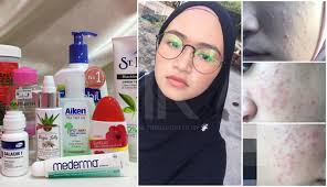 Please enter your email address below to create account. Muka Start Breakout Selepas Guna Local Product Nak Keluar Rumah Pun Malu The Reporter