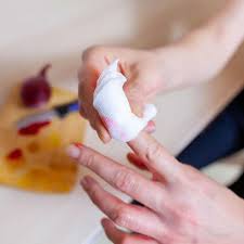 Wann kann ich mir das apartment anschauen? Schnittwunde Versorgen Mit Der Ilon Wundpflege Salbe